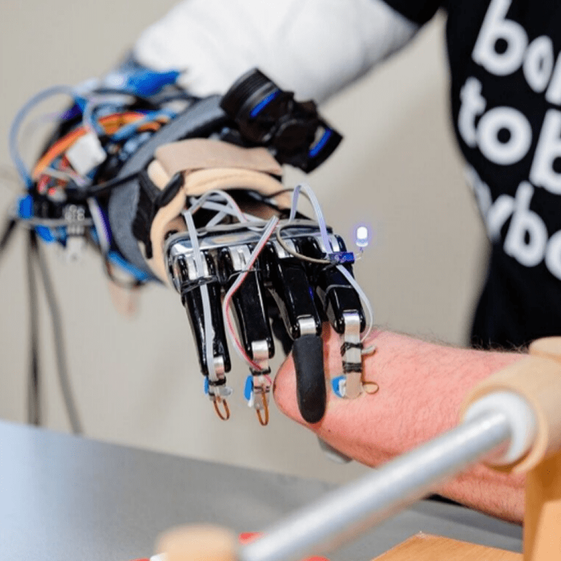 Протез с датчиками